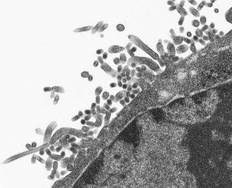 Microscopic view of influenza virus.