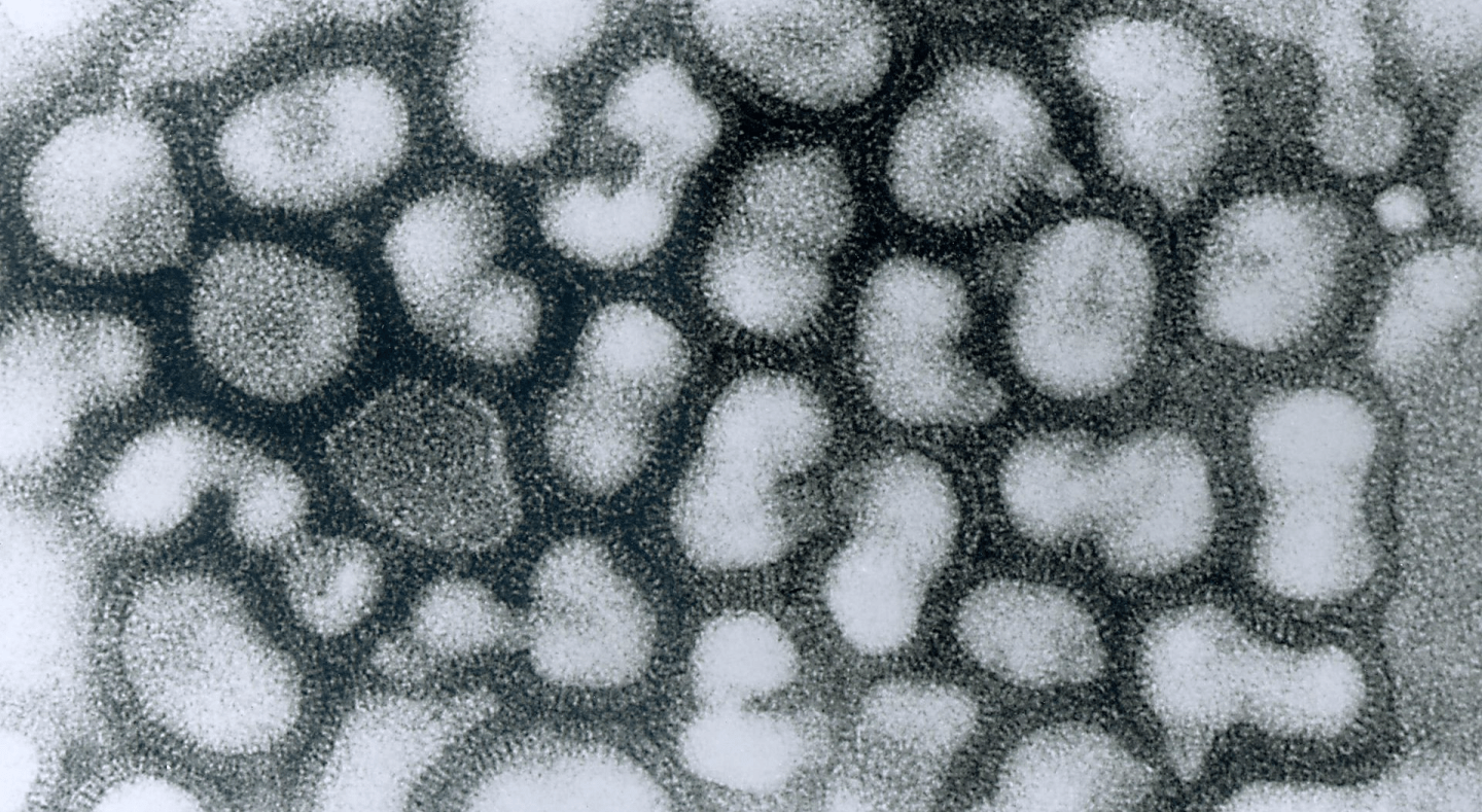 Transmission electron micrograph of influenza A virus.