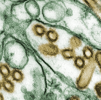 Electron micrograph of avian influenza.